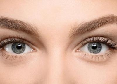 بوتاکس مژه چیست و چگونه انجام می شود؟ بوتاکس مژه چیست و چگونه انجام می شود؟